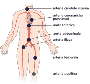 Aterosclerosi: cause, cure, esami, test clinico 3 Aterosclerosi e colesterolo. Aree maggiormente interessate dai depositi vascolari
