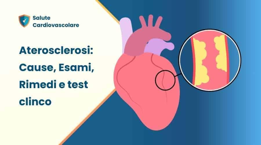 Aterosclerosi: cause, cure, esami, test clinico 2 Aterosclerosi, cause, sintomi, esami, fattori di rischio