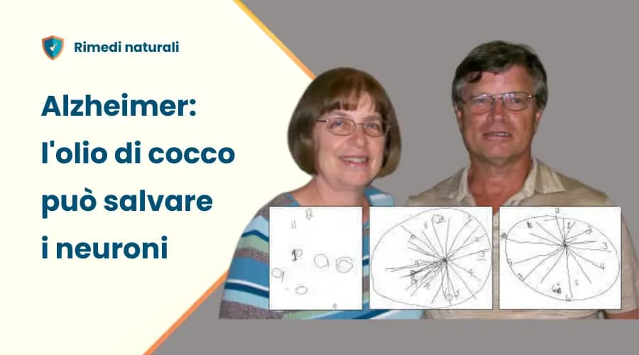 Alzheimer: l'olio di cocco può slavare i neuroni