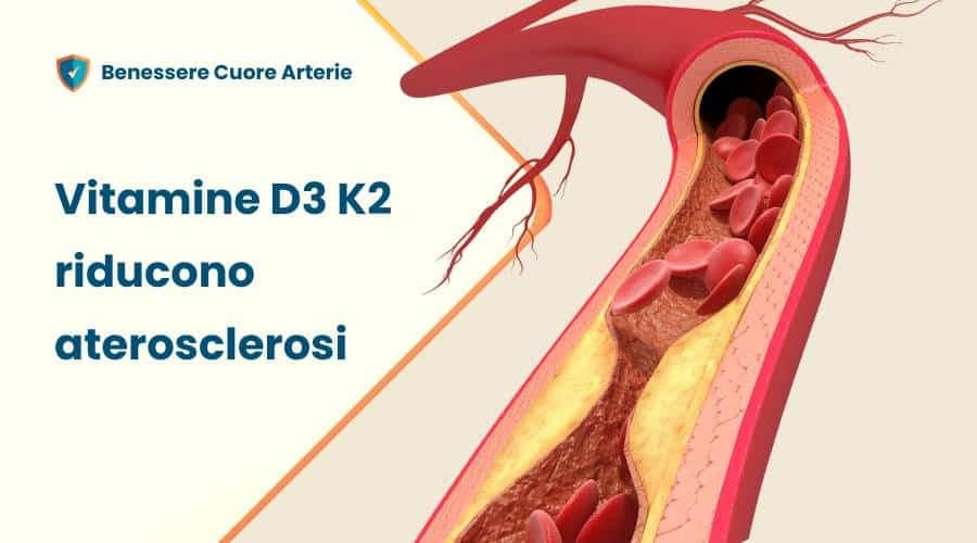 Vitamine D K2 riducono aterosclerosi