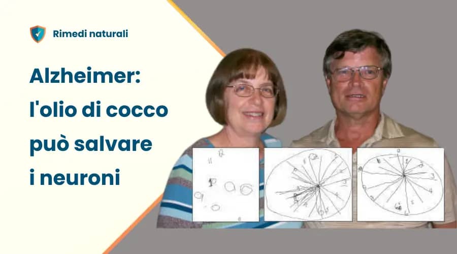 Alzheimer: l'olio di cocco può slavare i neuroni