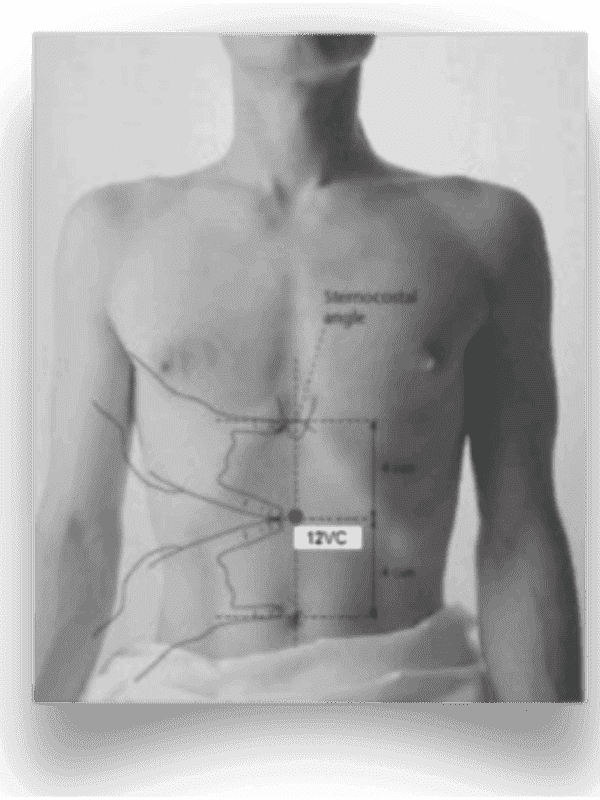 Digitopressione: l'agopuntura senza aghi 4 Digitopressione, agopuntura senza aghi. 12 VC